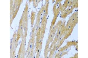 Immunohistochemistry of paraffin-embedded Rat heart using IGF2BP3 Polyclonal Antibody at dilution of 1:100 (40x lens). (IGF2BP3 抗体)