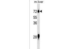 NOX3 Antibody (N-term) (ABIN1539578 and ABIN2849847) western blot analysis in mouse liver tissue lysates (35 μg/lane). (NOX3 抗体  (N-Term))