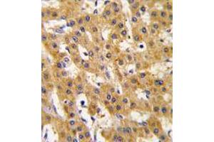 Image no. 3 for anti-Pyruvate Dehydrogenase Complex, Component X (PDHX) antibody (ABIN357415) (PDHX 抗体)
