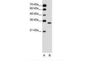 Image no. 1 for anti-Olfactory Receptor, Family 5, Subfamily T, Member 2 (OR5T2) (C-Term) antibody (ABIN6736622) (OR5T2 抗体  (C-Term))