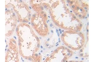 Immunohistochemistry (IHC) image for anti-Desmocollin 1 (DSC1) (AA 486-686) antibody (ABIN7436270)
