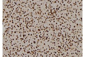 ABIN6276993 at 1/100 staining Mouse liver tissue by IHC-P. (RPL5 抗体  (Internal Region))