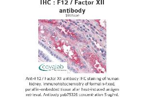 Image no. 1 for anti-Coagulation Factor XII (F12) antibody (ABIN1734212) (F12 抗体)
