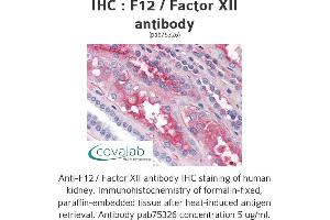 Image no. 1 for anti-Coagulation Factor XII (F12) antibody (ABIN1734212) (F12 抗体)