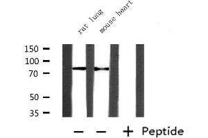Western blot analysis of extracts from mouse heart and rat lung, using PRMT7 Antibody. (PRMT7 抗体  (Internal Region))
