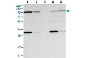 Western blot analysis of Lane 1: RT-4, Lane 2: U-251 MG, Lane 3: Human Plasma, Lane 4: Liver, Lane 5: Tonsil with EXOC2 polyclonal antibody  at 1:250-1:500 dilution. (EXOC2 抗体)