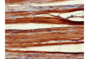 Immunohistochemistry of paraffin-embedded human skeletal muscle tissue using ABIN7166291 at dilution of 1:100 (Protein Wnt-1 (WNT1.L) (AA 160-372) 抗体)
