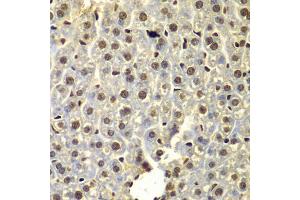 Immunohistochemistry of paraffin-embedded mouse liver using SSX5 antibody. (SSX5 抗体)