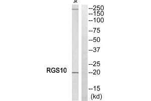 Western blot analysis of extracts from Jurkat cells, using RGS10 antibody. (RGS10 抗体  (Internal Region))