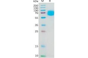 Human IL4RA Protein, hFc Tag on SDS-PAGE under reducing condition. (IL4 Receptor Protein (Fc Tag))