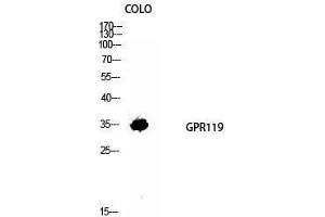 Western Blotting (WB) image for anti-G Protein-Coupled Receptor 119 (GPR119) (Internal Region) antibody (ABIN3184842) (G Protein-Coupled Receptor 119 抗体  (Internal Region))