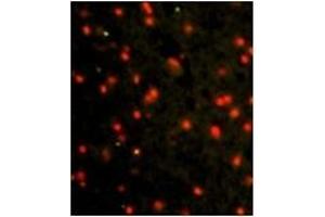 Image no. 1 for anti-Cadherin 4 (CDH4) (AA 182-211), (N-Term) antibody (ABIN356865) (Cadherin 4 抗体  (N-Term))