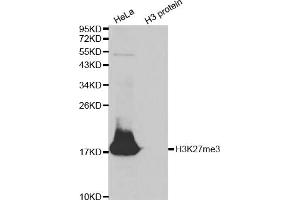 Western blot analysis of extracts of various cell lines, using Trimethyl-Histone H3-K27 antibody (ABIN5969810) at 1/500 dilution. (Histone 3 抗体  (H3K27me3))