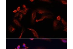 Immunofluorescence analysis of U2OS cells using TYMS Polyclonal Antibody at dilution of 1:100. (TYMS 抗体)