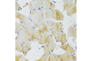 Immunohistochemistry of paraffin-embedded rat skeletal muscle using TRAP1 Antibody (ABIN1875197) at dilution of 1:100 (40x lens). (TRAP1 抗体)