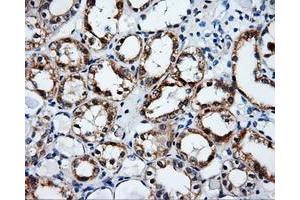 Immunohistochemical staining of paraffin-embedded Kidney tissue using anti-SRRmouse monoclonal antibody. (SRR 抗体)