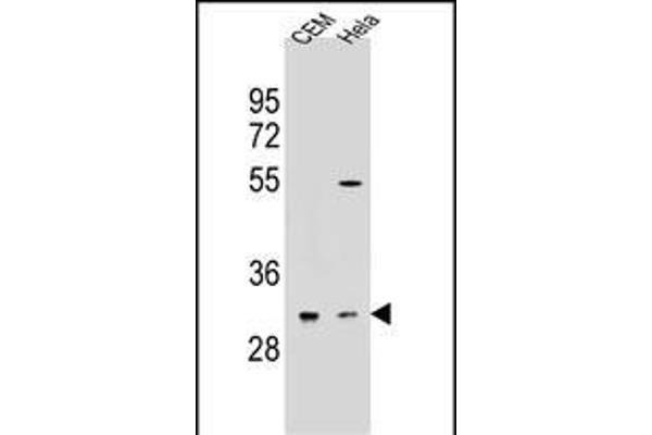 OR5L2 抗体  (N-Term)