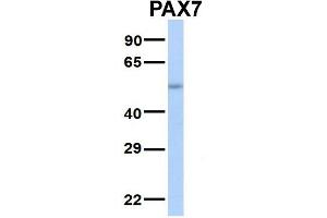 Host:  Rabbit  Target Name:  SERPINA3  Sample Type:  Human Adult Placenta  Antibody Dilution:  1. (PAX7 抗体  (Middle Region))
