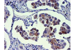 Image no. 5 for anti-Golgi Membrane Protein 1 (GOLM1) antibody (ABIN1498494) (GOLM1 抗体)