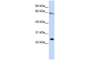 ZNF326 antibody used at 0. (ZNF326 抗体  (N-Term))