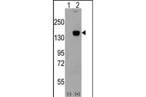 Western blot analysis of P3K5 (arrow) using rabbit polyclonal P3K5 Antibody g. (ASK1 抗体  (AA 821-849))