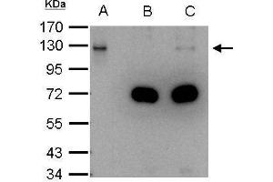 IP Image DDB1 antibody immunoprecipitates DDB1 protein in IP experiments. (DDB1 抗体  (C-Term))