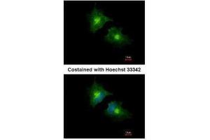 ICC/IF Image Immunofluorescence analysis of methanol-fixed HeLa, using SCAMP3, antibody at 1:1000 dilution. (SCAMP3 抗体)