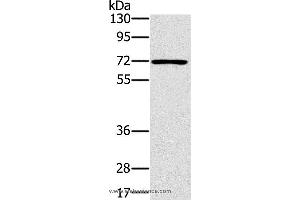 Western blot analysis of Raji cell, using PLS3 Polyclonal Antibody at dilution of 1:400 (Plastin 3 抗体)