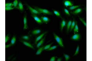 Immunofluorescence staining of Hela cells with ABIN7175108 at 1:33, counter-stained with DAPI. (UMPS 抗体  (AA 314-444))