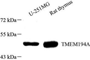 Western blot analysis of TMEM194A (ABIN7075997) at dilution of 1: 1000 (TMEM194A 抗体)