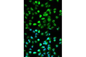 Immunofluorescence analysis of HeLa cell using TCF4 antibody. (TCF4 抗体)