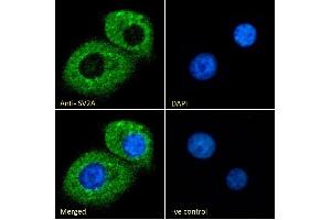 (ABIN185715) Immunofluorescence analysis of paraformaldehyde fixed KNRK cells, permeabilized with 0. (SV2A 抗体  (Internal Region))