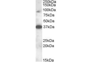 Image no. 1 for anti-Membrane-Associated Ring Finger (C3HC4) 10, E3 Ubiquitin Protein Ligase (MARCH10) (Internal Region) antibody (ABIN375020) (MARCH10 抗体  (Internal Region))