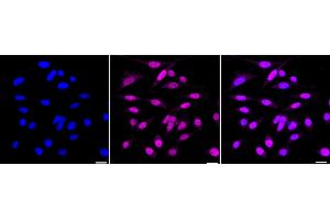 Immunocytochemical staining of HepG2 cells with JunD antibody (ABIN7799143), 1:1,000). (Recombinant JunD 抗体)