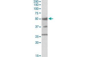 FOXA1 polyclonal antibody  staining (1 ul/mL) of HepG2 cell lysate (35 ug protein in RIPA buffer). (FOXA1 抗体  (C-Term))