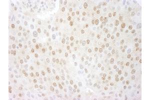 Immunohistochemistry (IHC) image for anti-COP9 Constitutive Photomorphogenic Homolog Subunit 5 (Arabidopsis) (COPS5) (AA 175-225) antibody (ABIN7448494)