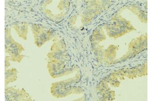 ABIN6273028 at 1/100 staining Mouse colon tissue by IHC-P. (SLC30A6 抗体  (Internal Region))