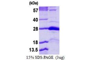 Serine/threonine/tyrosine Interacting Protein (STYX) (AA 26-223) protein (His tag)