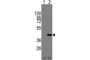 Western blot analysis of MAPK14(arrow) using rabbit polyclonal MAPK14 Antibody (Y322) .