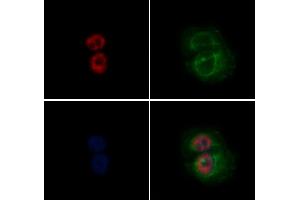 ABIN6265926 and ABIN6272455 staining Hela by IF/ICC. (USP36 抗体  (Internal Region))