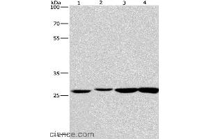 Western blot analysis of Humna colon cancer and mouse kidney tissue, mouse testis and human fetal brain tissue, using KLF7 Polyclonal Antibody at dilution of 1:483. (KLF7 抗体)