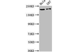 Western Blot Positive WB detected in: Hela whole cell lysate, U87 whole cell lysate All lanes: SCN10A antibody at 12 μg/mL Secondary Goat polyclonal to rabbit IgG at 1/50000 dilution Predicted band size: 221 kDa Observed band size: 221 kDa (SCN1A 抗体  (AA 992-1099))