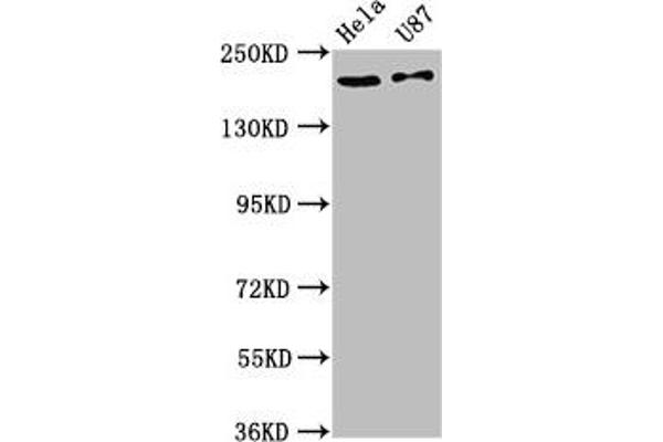 SCN1A Antikörper  (AA 992-1099)