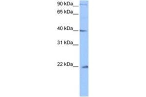 Western Blotting (WB) image for anti-Chromosome 4 Open Reading Frame 33 (C4orf33) antibody (ABIN2463479) (C4orf33 抗体)