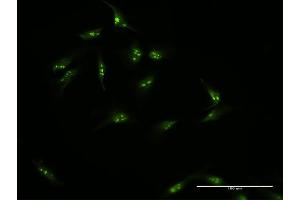 Immunofluorescence (IF) image for anti-Nucleolar Protein 16 (NOP16) (AA 1-178) antibody (ABIN526757)