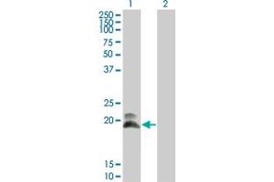 Western Blot analysis of HAND2 expression in transfected 293T cell line by HAND2 monoclonal antibody (M01), clone 4H8. (HAND2 抗体  (AA 135-216))