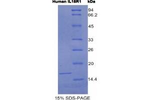 SDS-PAGE analysis of Human IL18R1 Protein. (IL18R1 蛋白)