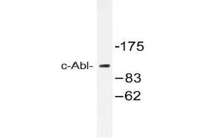 Western blot analysis of c-Abl Antibody in extracts from 293 cells. (ABL1 抗体)