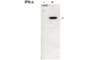 Western Blotting (WB) image for anti-Signal Transducer and Activator of Transcription 2, 113kDa (STAT2) (pTyr690) antibody (ABIN349594)
