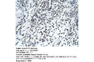Human kidney (SIRT5 抗体  (Middle Region))
